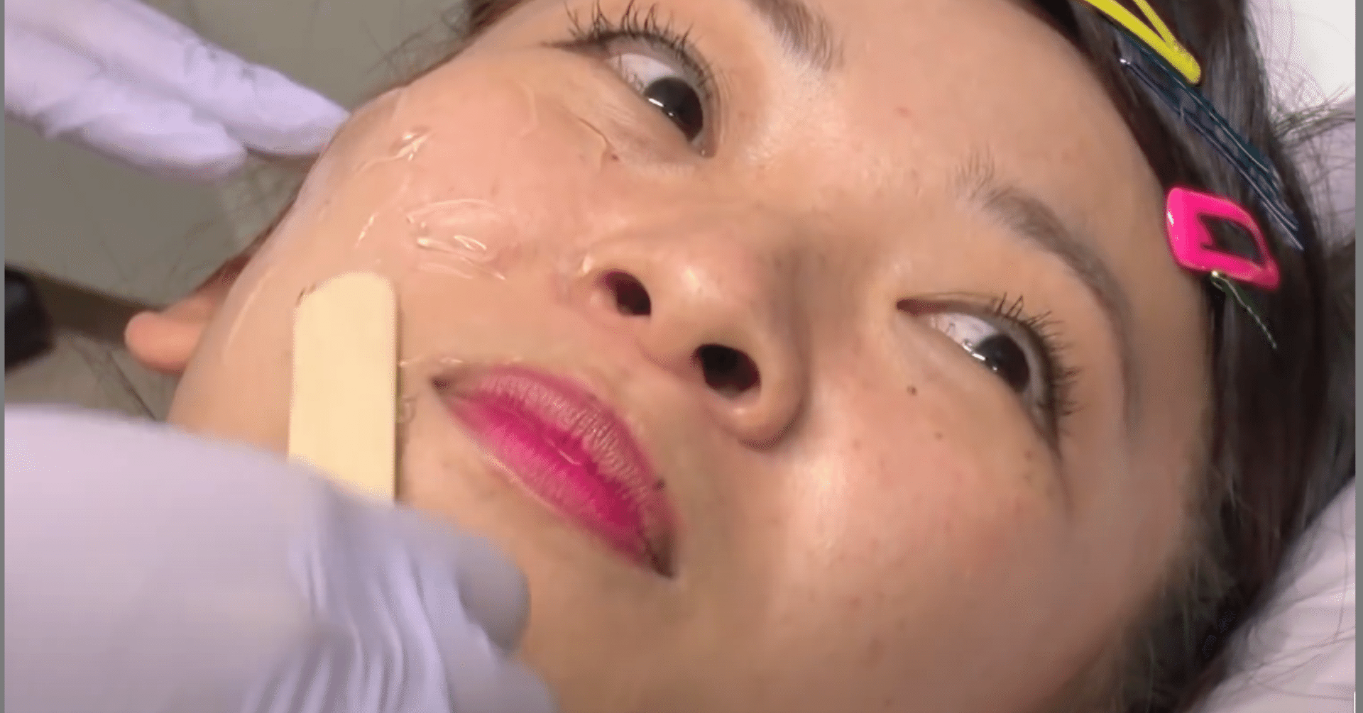 フワちゃんのシミ取りはどこの皮膚科 シミだらけスッピン顔に衝撃 21 Minn Note