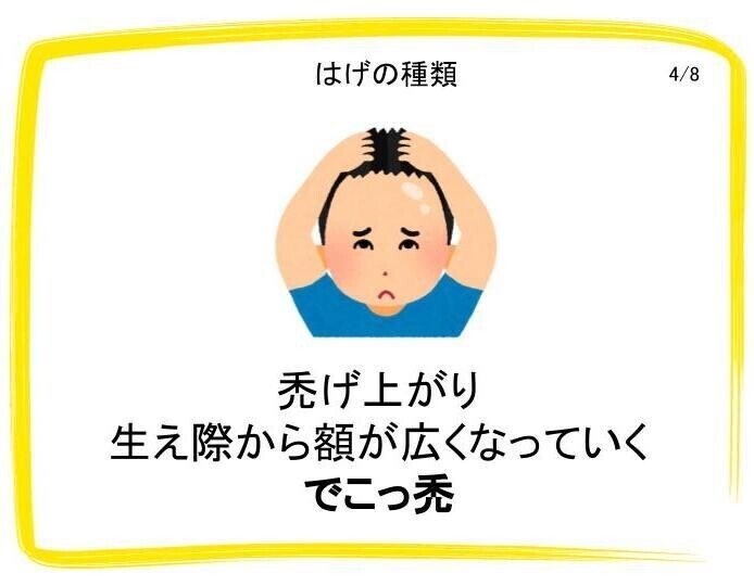 はげ Taku Note