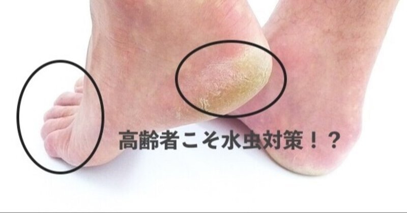 爪水虫 の新着タグ記事一覧 Note つくる つながる とどける 爪水虫 の新着タグ記事一覧 Note つくる つながる とどける