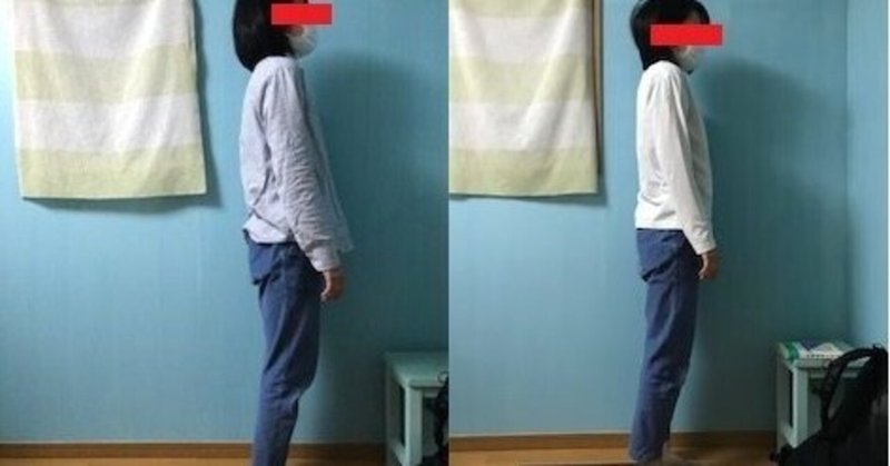 猫背は治る の新着タグ記事一覧 Note つくる つながる とどける 猫背は治る の新着タグ記事一覧 Note つくる つながる とどける
