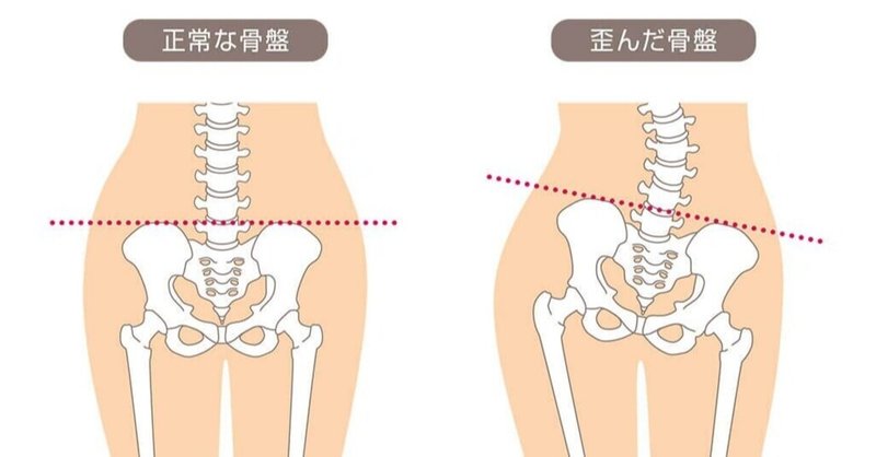 梨状筋 の新着タグ記事一覧 Note つくる つながる とどける