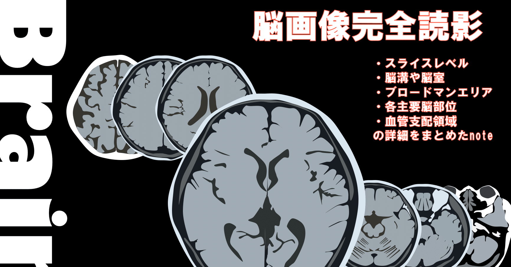 完成版 脳画像の見方はこれで十分 スライスレベルから血管支配 病態特徴まで完全網羅 Rehaidea Note 完成版 脳画像の見方はこれで十分 スライスレベルから血管支配 病態特徴まで完全網羅 Rehaidea Note
