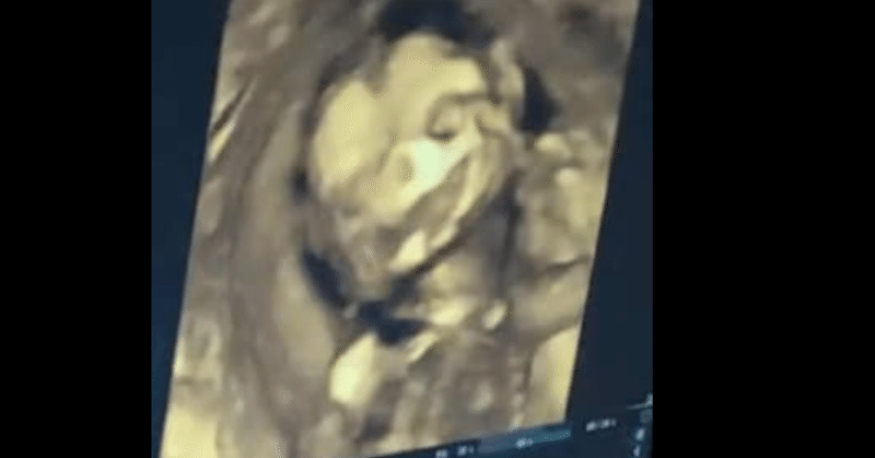 中絶手術 の新着タグ記事一覧 note つくる つながる とどける