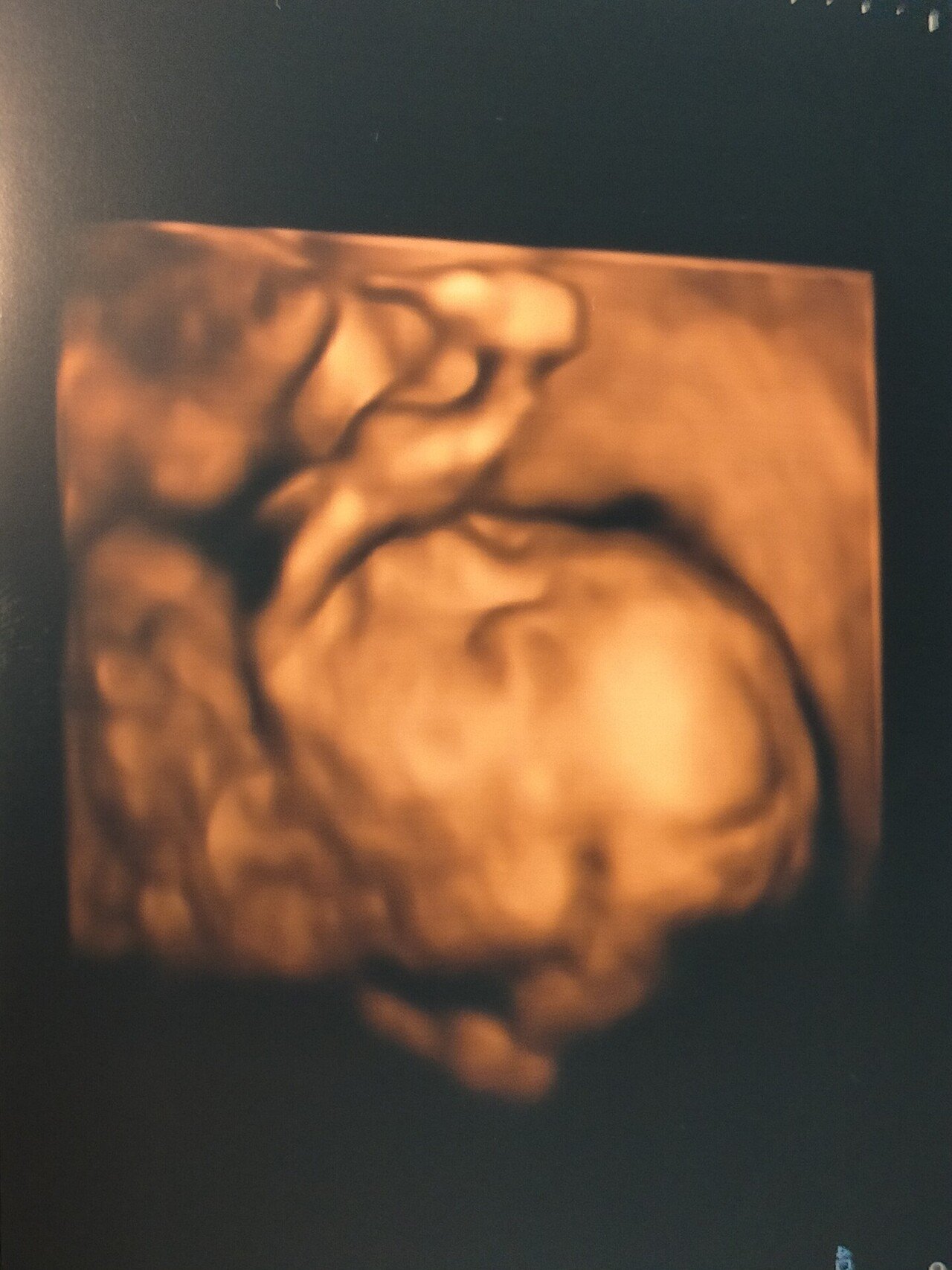 4dエコーやりました 写真あり 妊娠22ｗ6ｄ Kelly Note