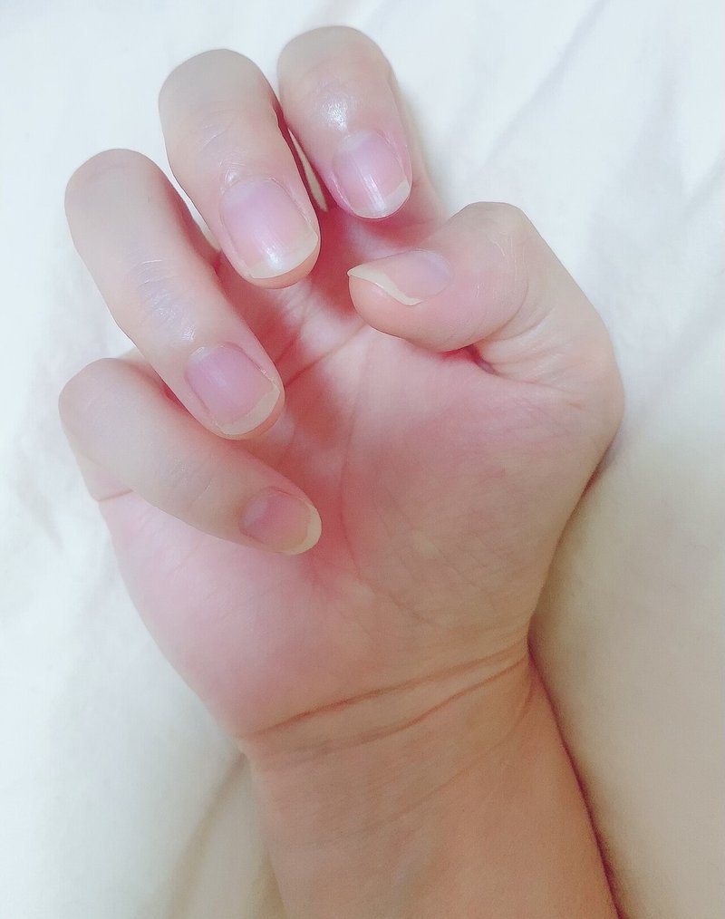 趣味をきっかけに長年の爪噛み癖を治そうと思ったオタク女の話 おじさん Note 趣味をきっかけに長年の爪噛み癖を治そうと思ったオタク女の話 おじさん Note