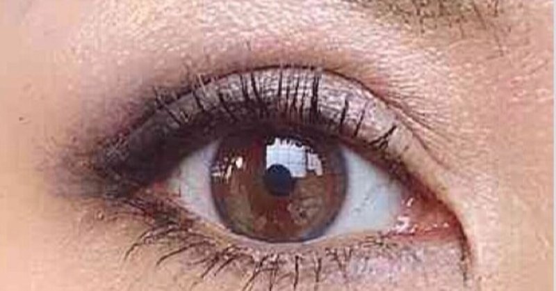 二重全切開 3 目頭切開失敗 Marilyn Note