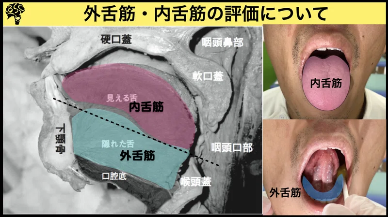 初期評価で『舌機能』を診るべきPoint 〜舌の解剖について〜｜小西弘晃/理学療法士/摂食嚥下