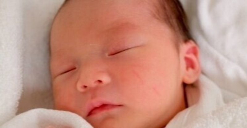 じんましん と 湿疹 の違い こども アレルギー 小児科医 Note じんましん と 湿疹 の違い こども アレルギー 小児科医 Note