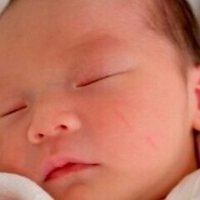 アレルギーに配慮した離乳食の進め方 こども アレルギー 小児科医 Note