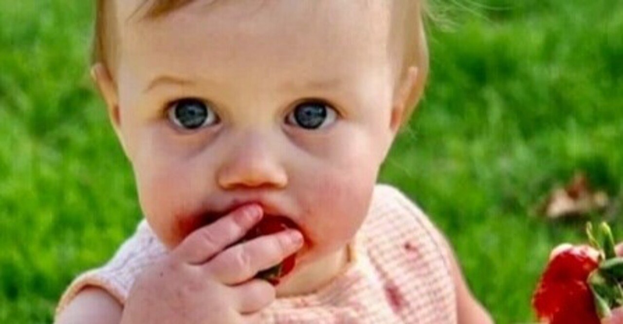 食物アレルギー 食べたら口の周りが赤くなった こども アレルギー 小児科医 Note