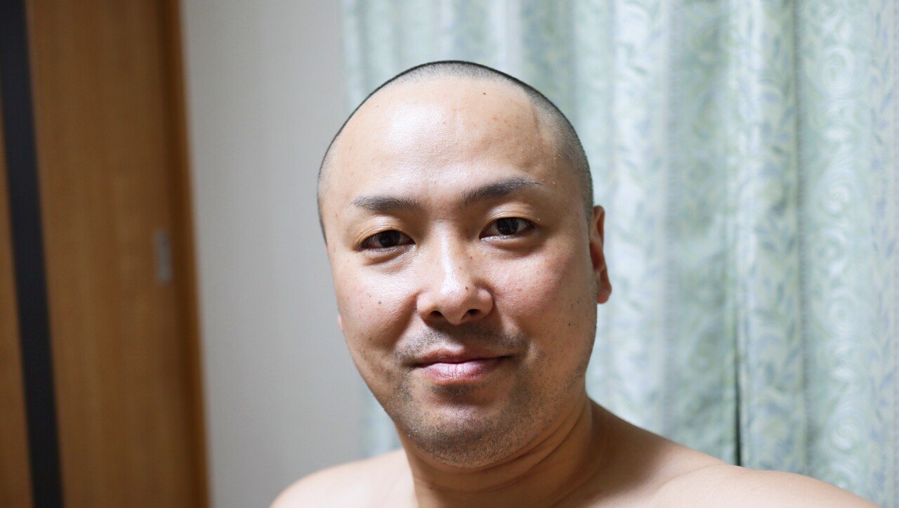 悩みこそさらけ出せ スキンヘッドにすれば全ては丸く収まる 高橋 優介 越後妻有の料理人タカハシ Note 悩みこそさらけ出せ スキンヘッドにすれば全ては丸く収まる 高橋 優介 越後妻有の料理人タカハシ Note