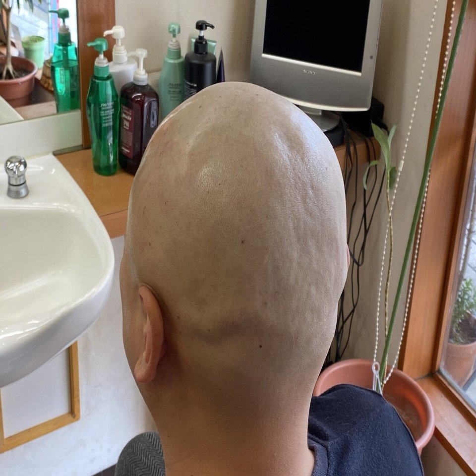 悩みこそさらけ出せ スキンヘッドにすれば全ては丸く収まる 高橋 優介 越後妻有の料理人タカハシ Note