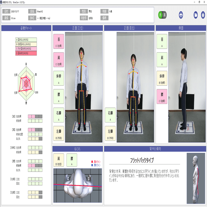 ゆがんでる？社員の姿勢を計測してみた｜キッセイコムテック / 生体