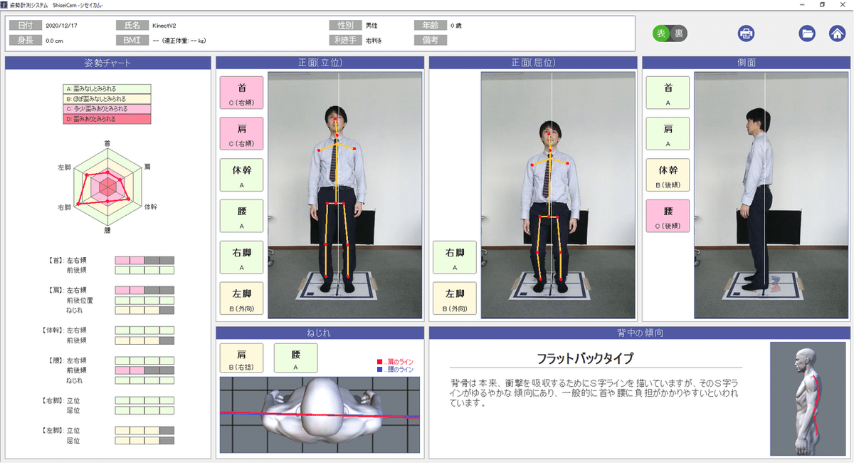 ゆがんでる？社員の姿勢を計測してみた｜キッセイコムテック