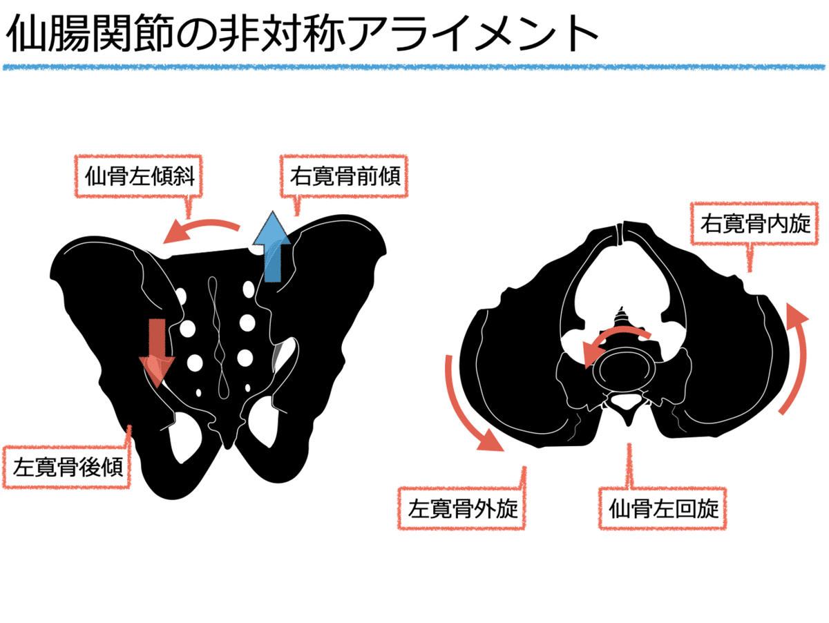 三浦誠の「1分完結-SH矯正法マスタープログラム」骨盤 仙腸関節 三浦誠の「1分完結-SH矯正法マスタープログラム」骨盤 仙腸関節