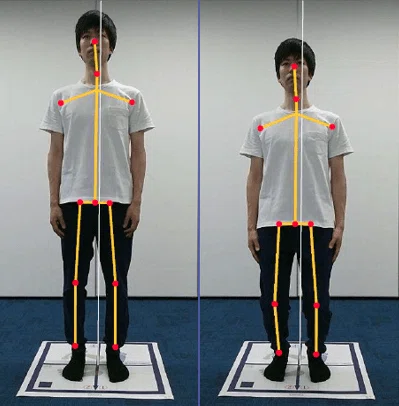 ShiseiCam 姿勢計測システム 姿勢分析　シセイカム　接骨院　整体 ゆがんでる？社員の姿勢を計測してみた｜キッセイコムテック / 生体