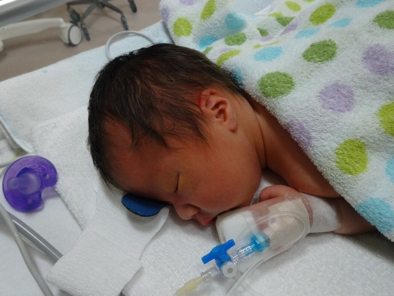 脊髄髄膜流の息子 成長の記録 生後5日目に水頭症の手術 生後1か月ごろ ここ Note