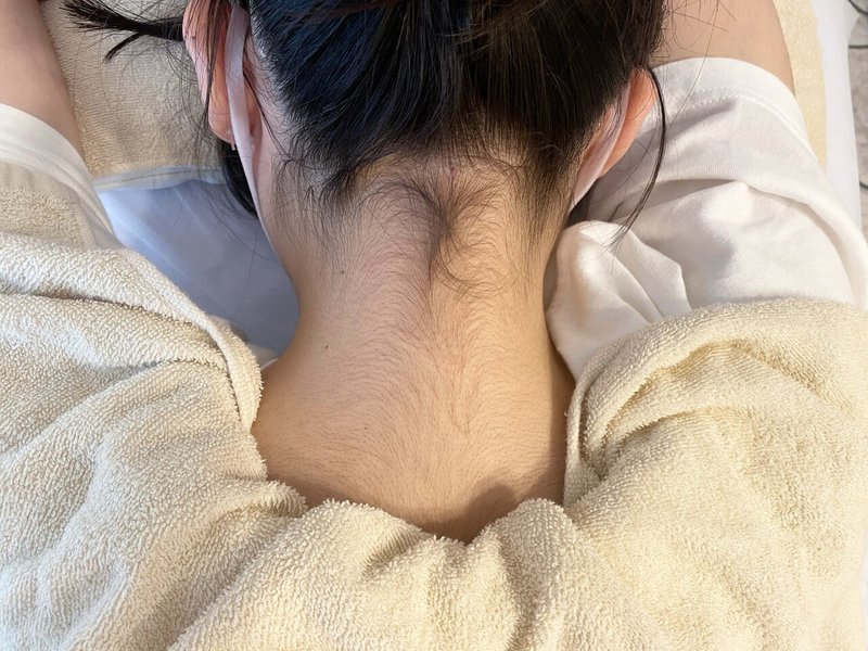 学校生活や部活で髪を上げる際の うなじ が気になる ワックス脱毛は未成年の方への施術も可能です Arisa Yamasaki Note
