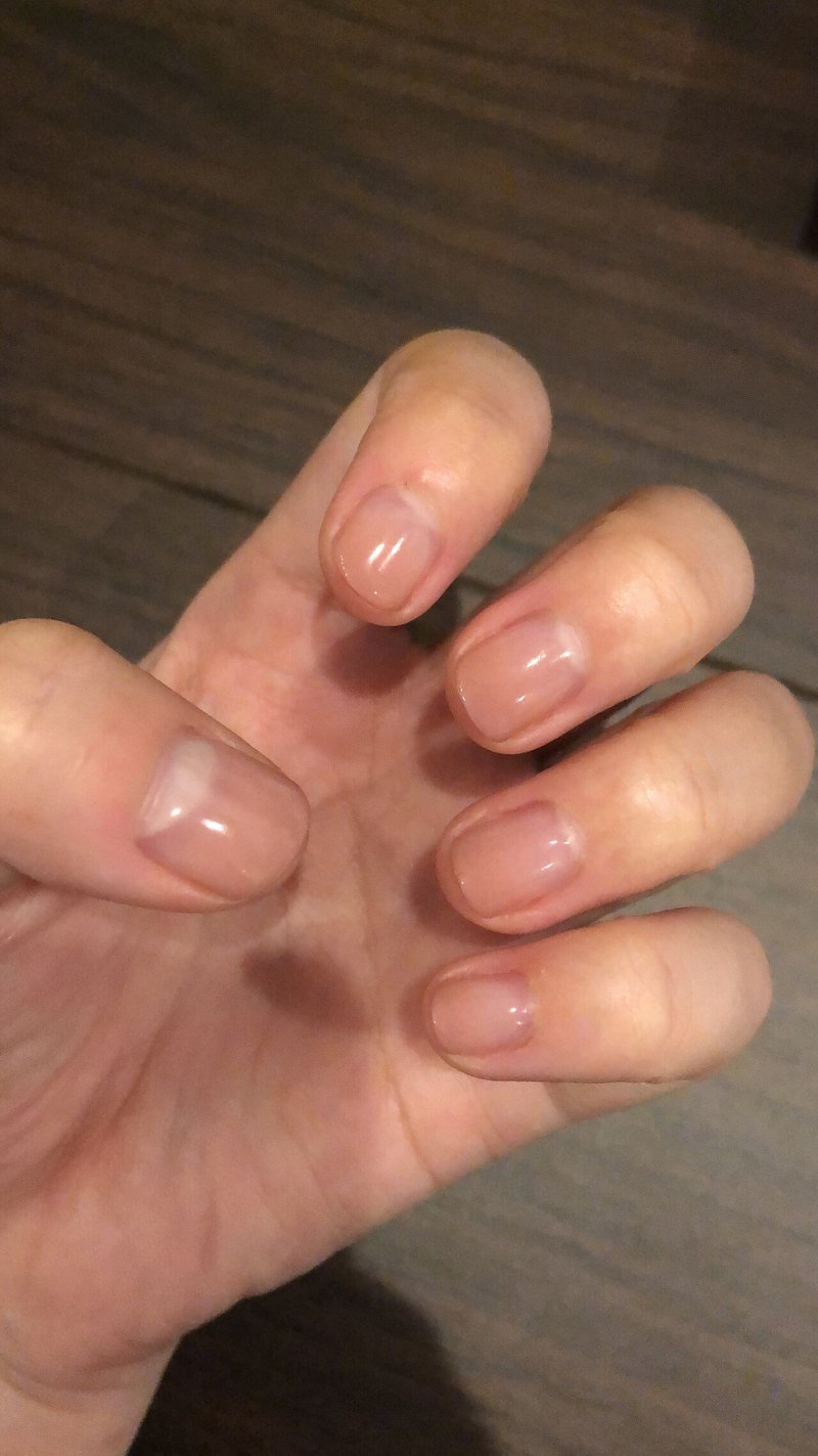 深爪だった私が半年で人前に出しても恥ずかしくない爪になった話 いずみ Note 深爪だった私が半年で人前に出しても恥ずかしくない爪になった話 いずみ Note