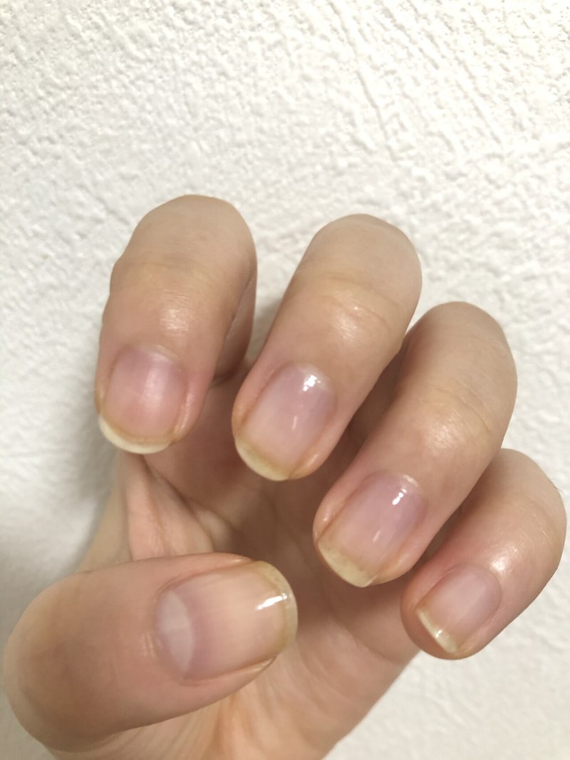 深爪だった私が半年で人前に出しても恥ずかしくない爪になった話 いずみ Note 深爪だった私が半年で人前に出しても恥ずかしくない爪になった話 いずみ Note