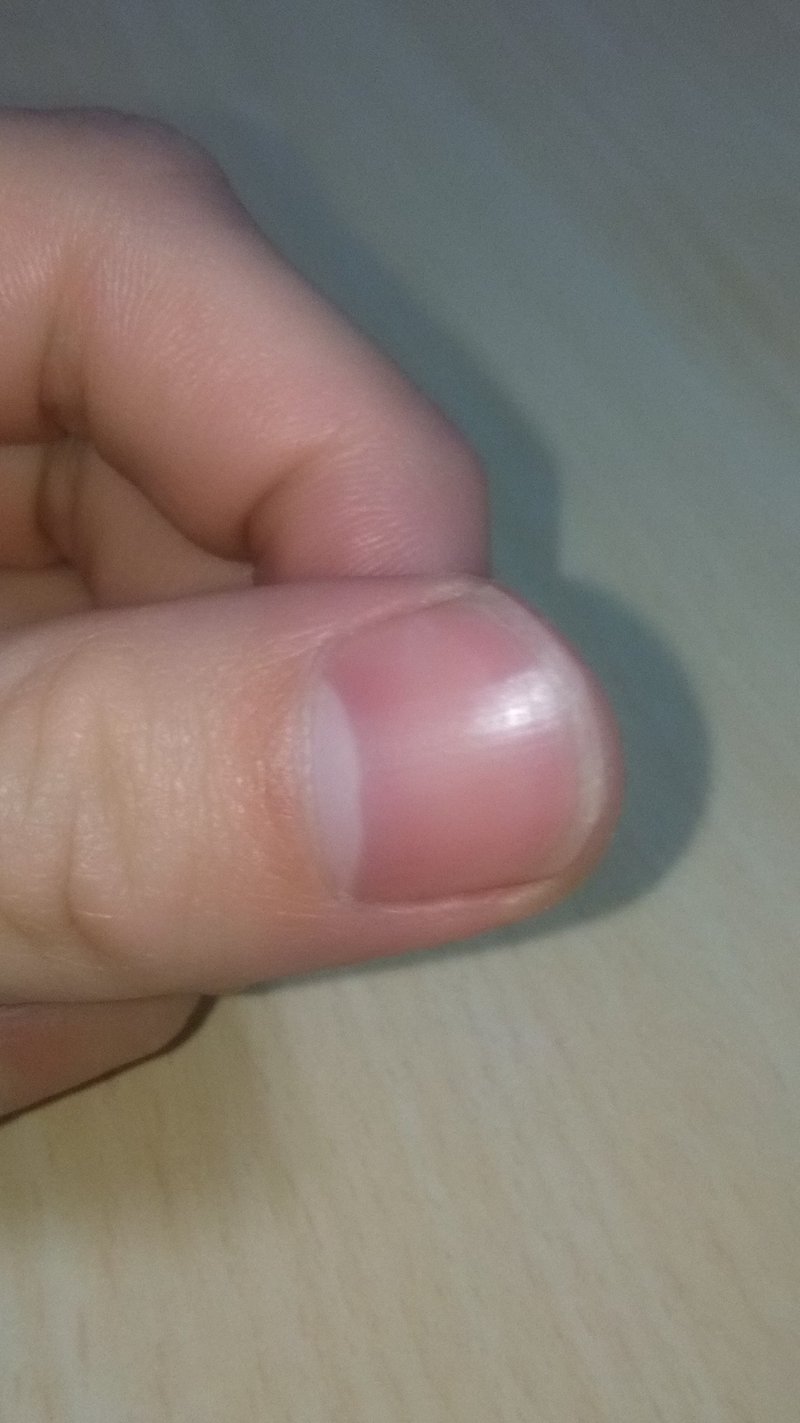 セリアで買えるもので爪手入れをしてみた またたび Note