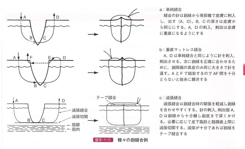 創傷処置(汚染創の処置)|Dr.モリモト’s NOTE