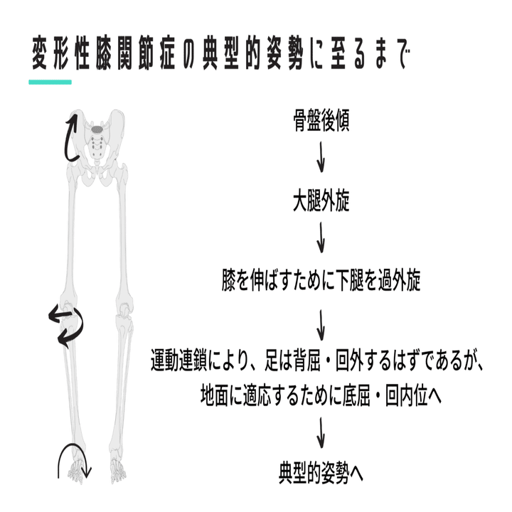 股関節からみた変形性膝関節症｜武田 純一