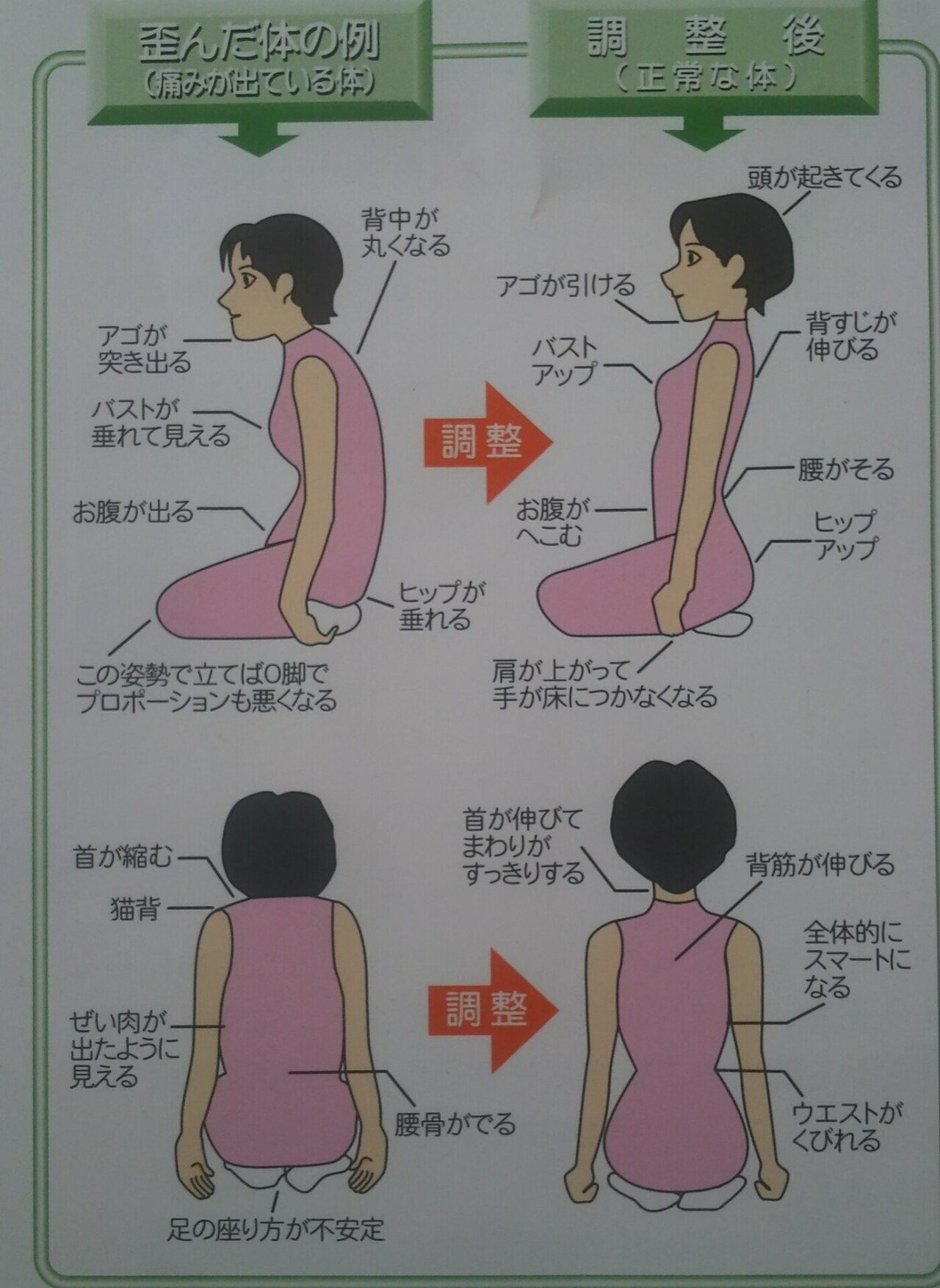 しびれはどうやって起きるのか いたじま健康院 Note しびれはどうやって起きるのか いたじま健康院 Note