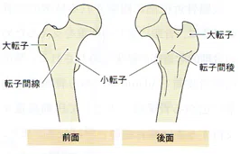 股関節OAを診る上で必要な知識②骨、寛骨臼形成不全症、大腿骨近