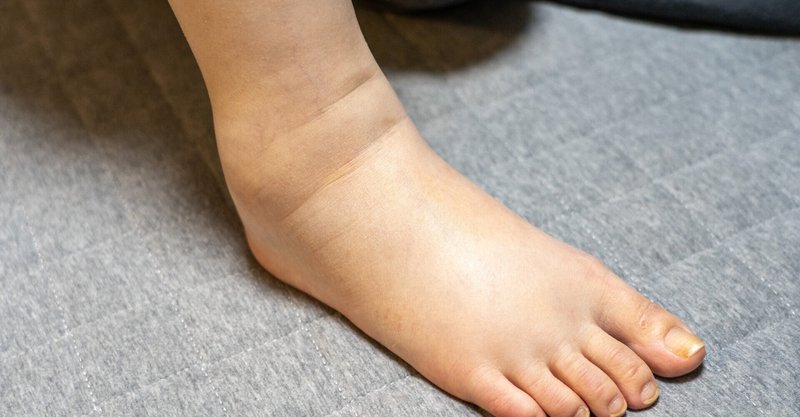 妊娠中のむくみの原因と改善方法 マタニティ整体ミルク Note 妊娠中のむくみの原因と改善方法 マタニティ整体ミルク Note