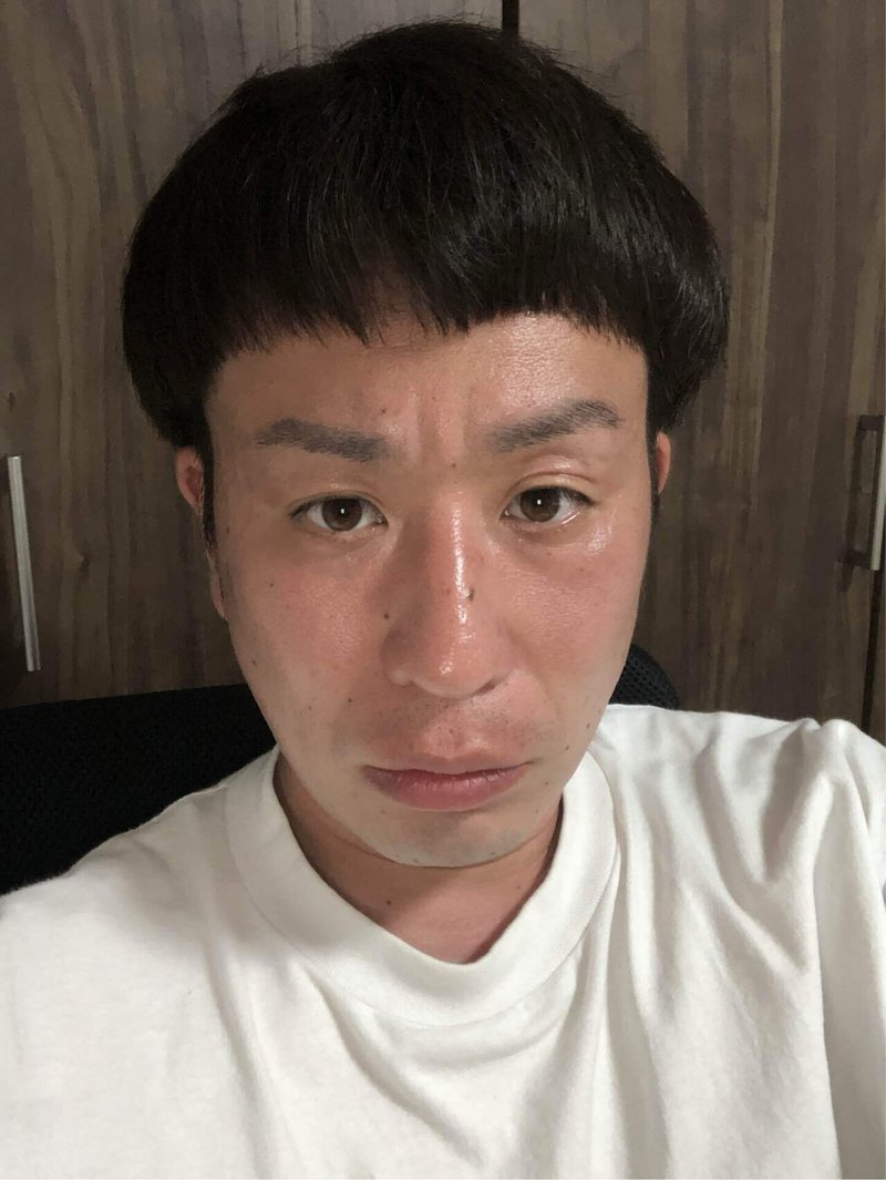 日焼けしました 芸人 こーぞー Note