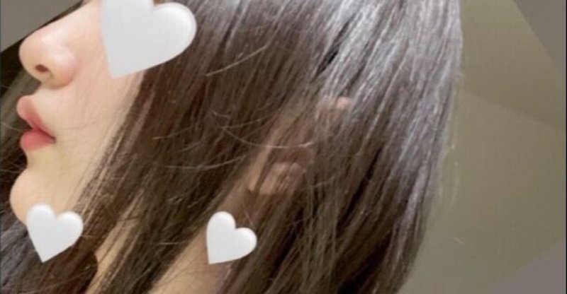 頬骨とエラ 自撮り倉庫歯列矯正メモ リッ Note