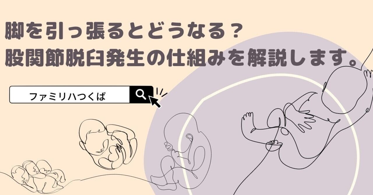 脚を引っ張るとどうなる 小児整形外科専門医が股関節脱臼発生の仕組みを解説します ファミリハつくば Note
