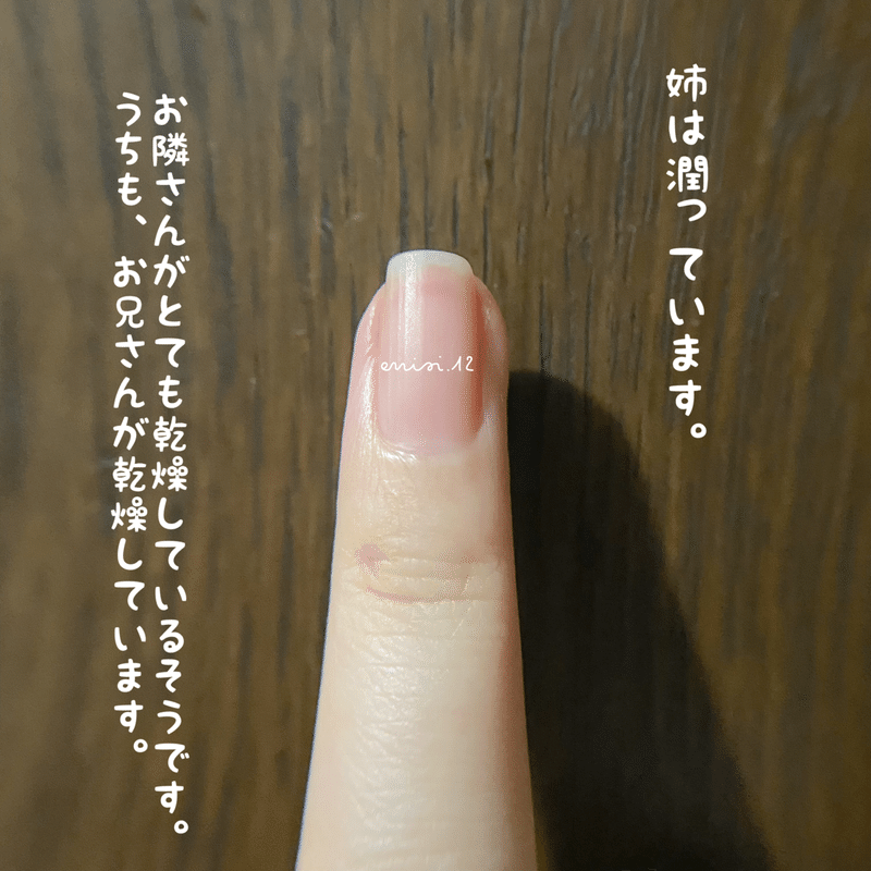 爪周りの乾燥 Sayaka Enisi 12 Note