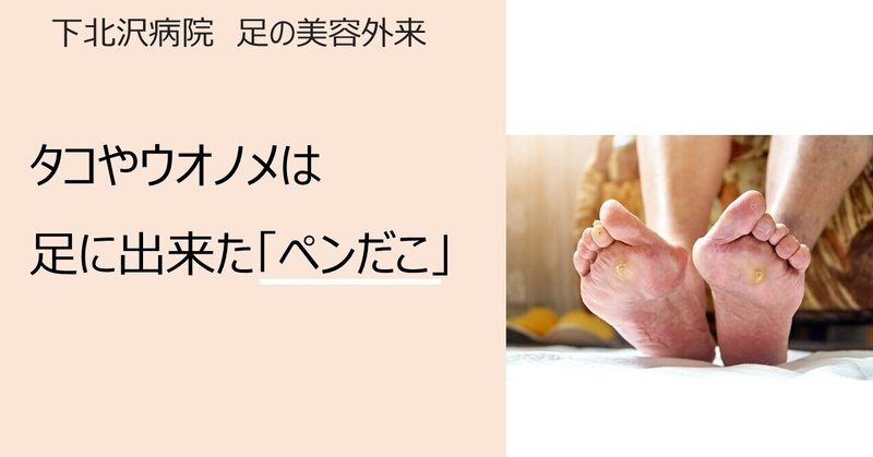 タコやウオノメは足にできたペンだこ 菊池 守 足専門の医師 Note タコやウオノメは足にできたペンだこ 菊池 守 足専門の医師 Note