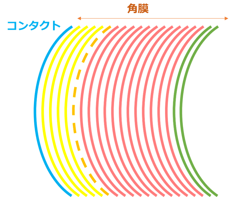 ソフトコンタクトユーザーが眼鏡にしたほうがいい理由と ファストブランドでレンズを買わないほうがいい理由 S H I M P E I Note