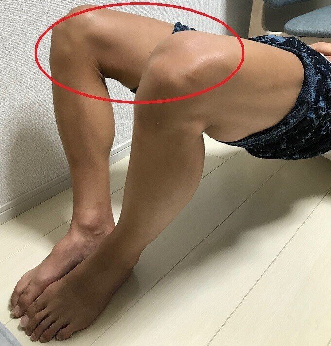 外旋①を拡大表示