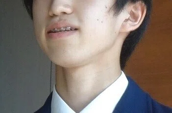 Y歯科矯正