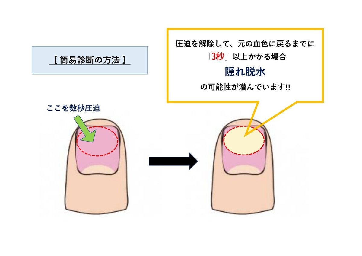 脱水簡易診断_page-0001