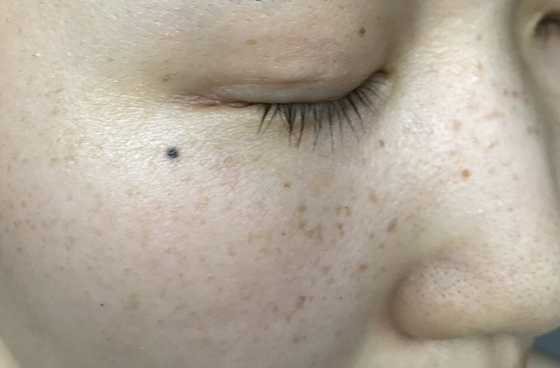 ゆる肌断食 2日目 ちくわ Note