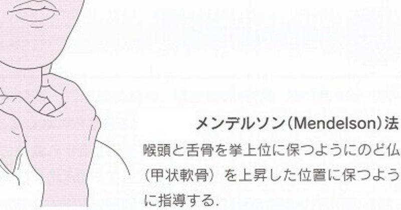 メンデルソン手技