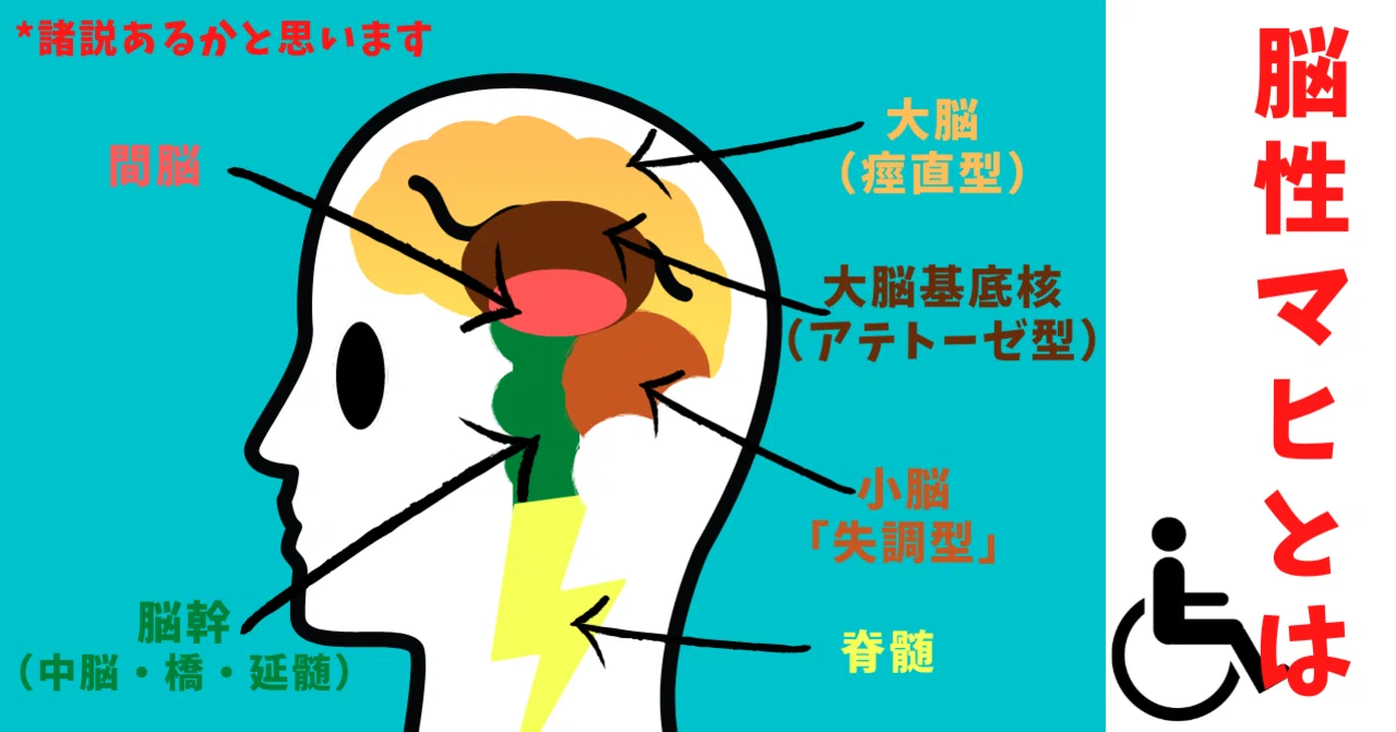 脳性麻痺｜こども勉強室こぶた
