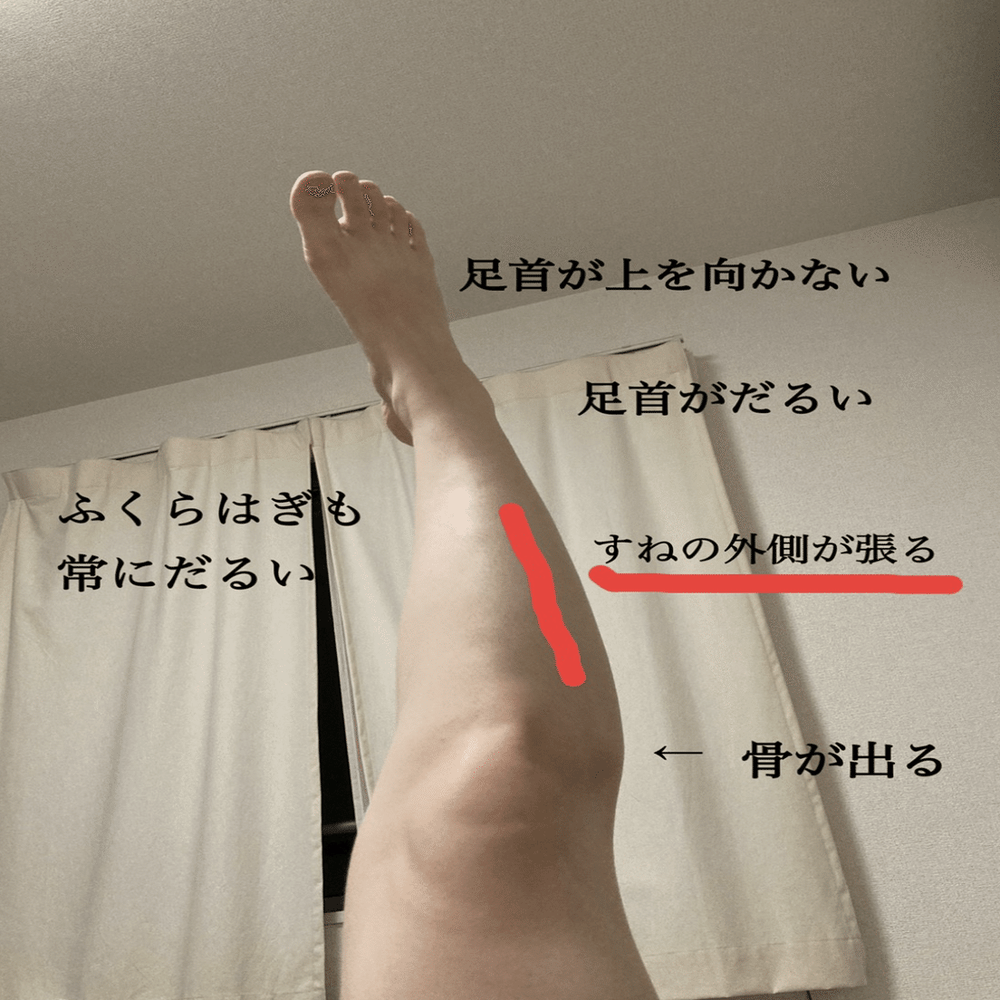 足部の機能改善 足部 下腿周辺の痛み 張り感の捉え方と改善方法 薬師寺偲 理学療法士 ピラティス Note