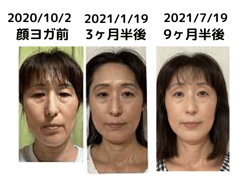 顔ヨガを日課にされて前向きに ひよきよ Note