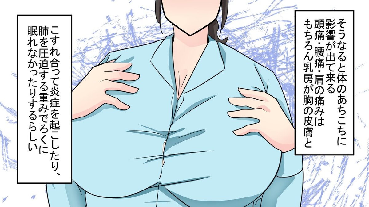 巨乳症 