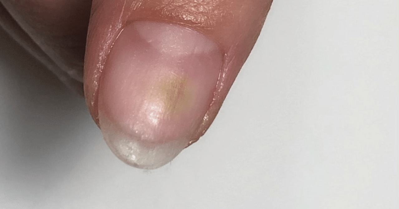 グリーンネイルはなぜなるの お直しゼロ 長持ちネイルをつくれる Okawari おかわり ジェル Note