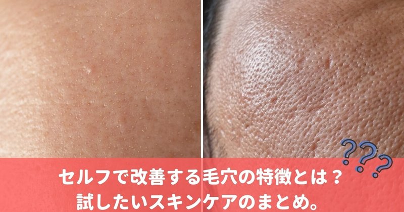 毛穴が閉じない 人必見 セルフケアで使うべきスキンケアとは 美容ライターまめ Note 毛穴が閉じない 人必見 セルフケアで使うべきスキンケアとは 美容ライターまめ Note