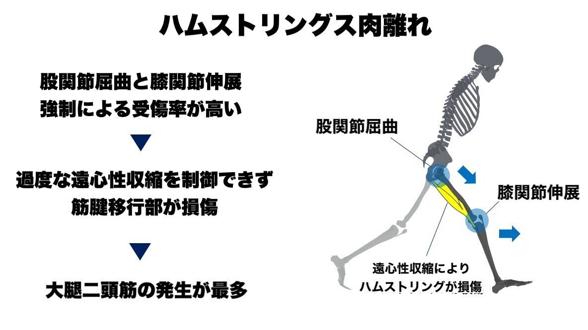 スポーツ復帰に向けたハムストリングス肉離れに対するアプローチ L Fit Note