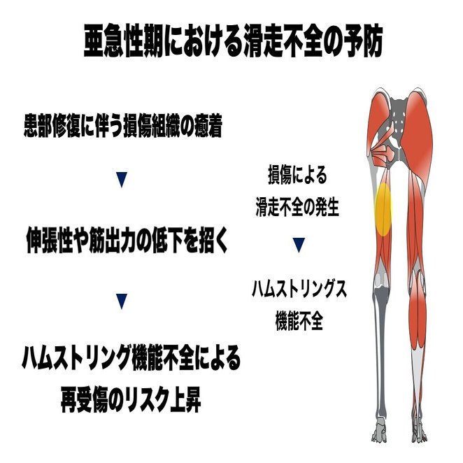 スポーツ復帰に向けたハムストリングス肉離れに対するアプローチ L Fit Note