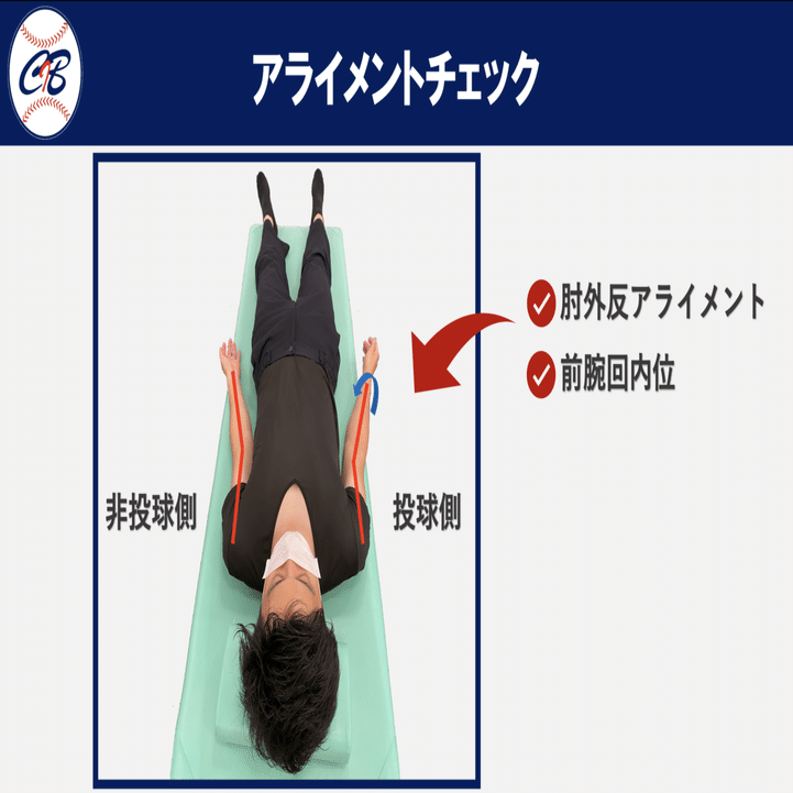 投球障害肘改善のための肘伸展機能評価とアプローチ【トレーナー